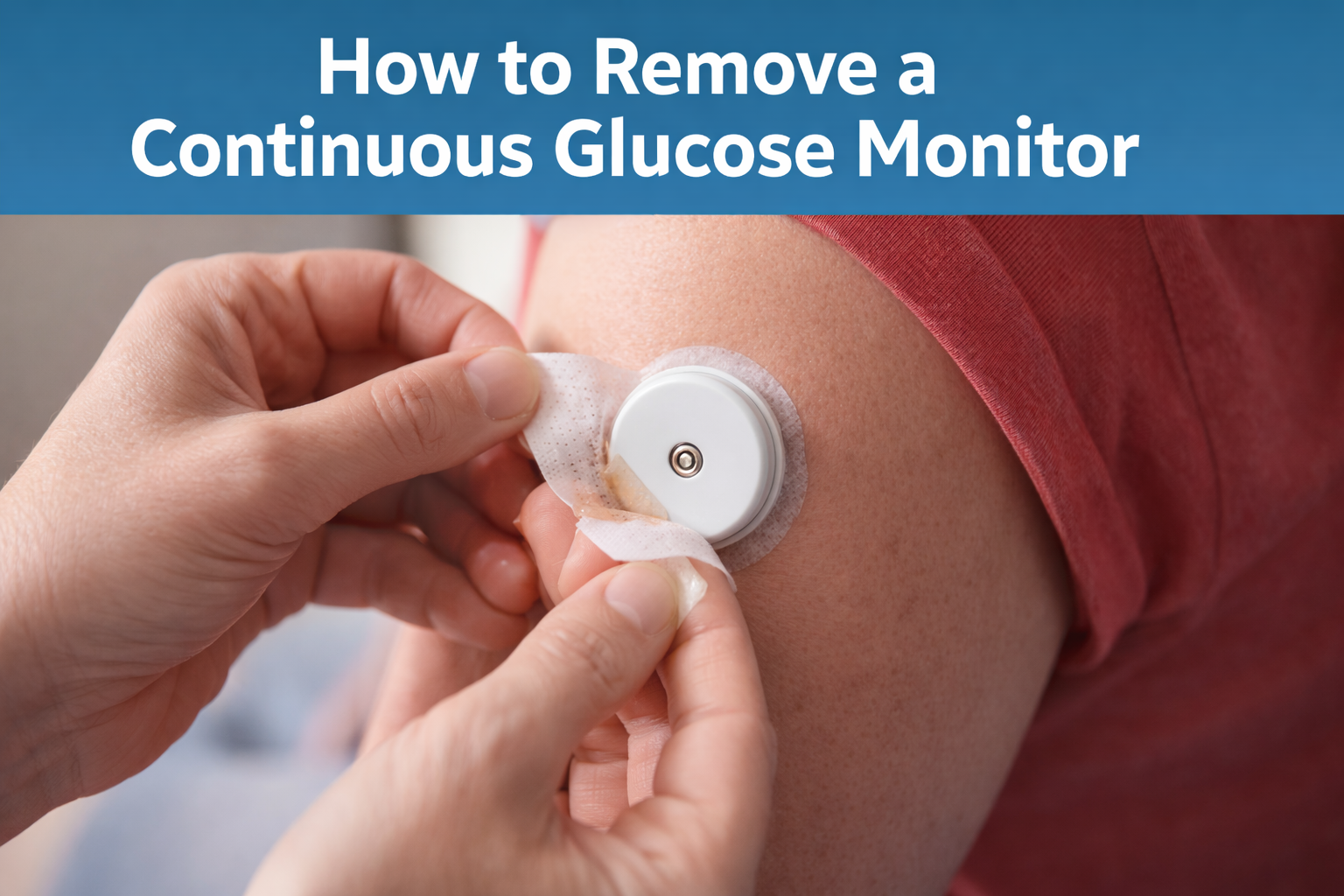 Hands gently removing a continuous glucose monitor sensor from the upper arm, showing safe CGM removal with medical adhesive patch.